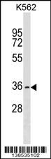 OR2AG2 Antibody
