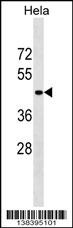 SERPINB11 Antibody