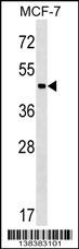 ZBTB12 Antibody