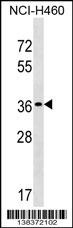 TP53TG5 Antibody