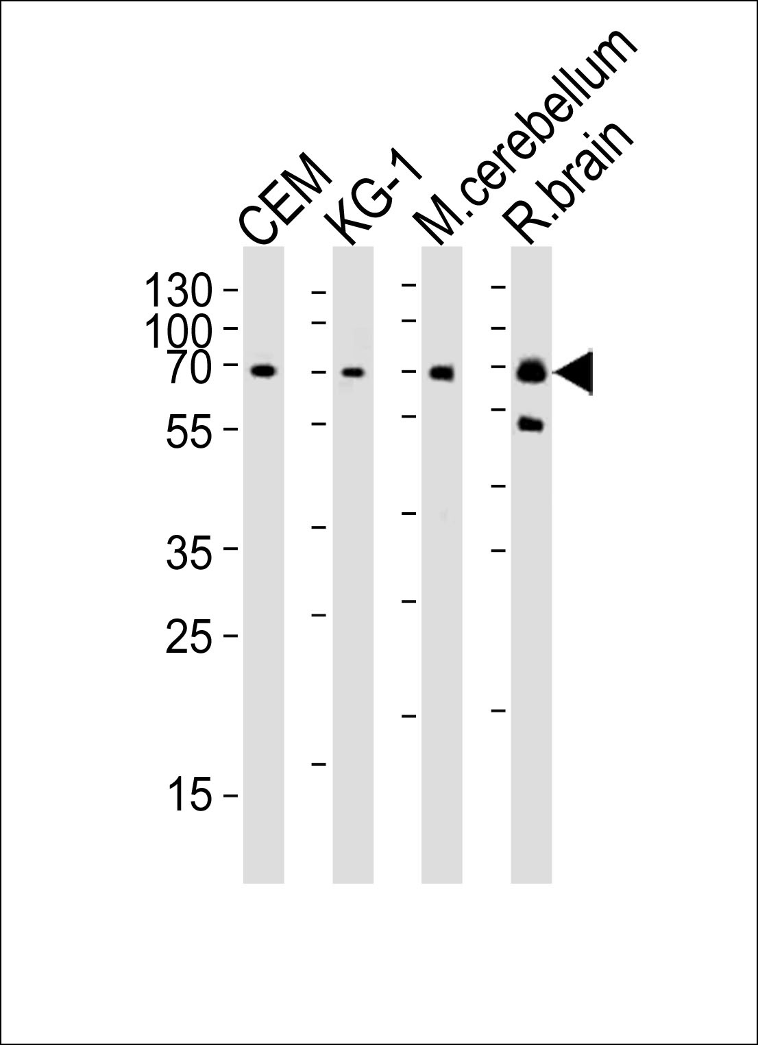 MTF2 Antibody