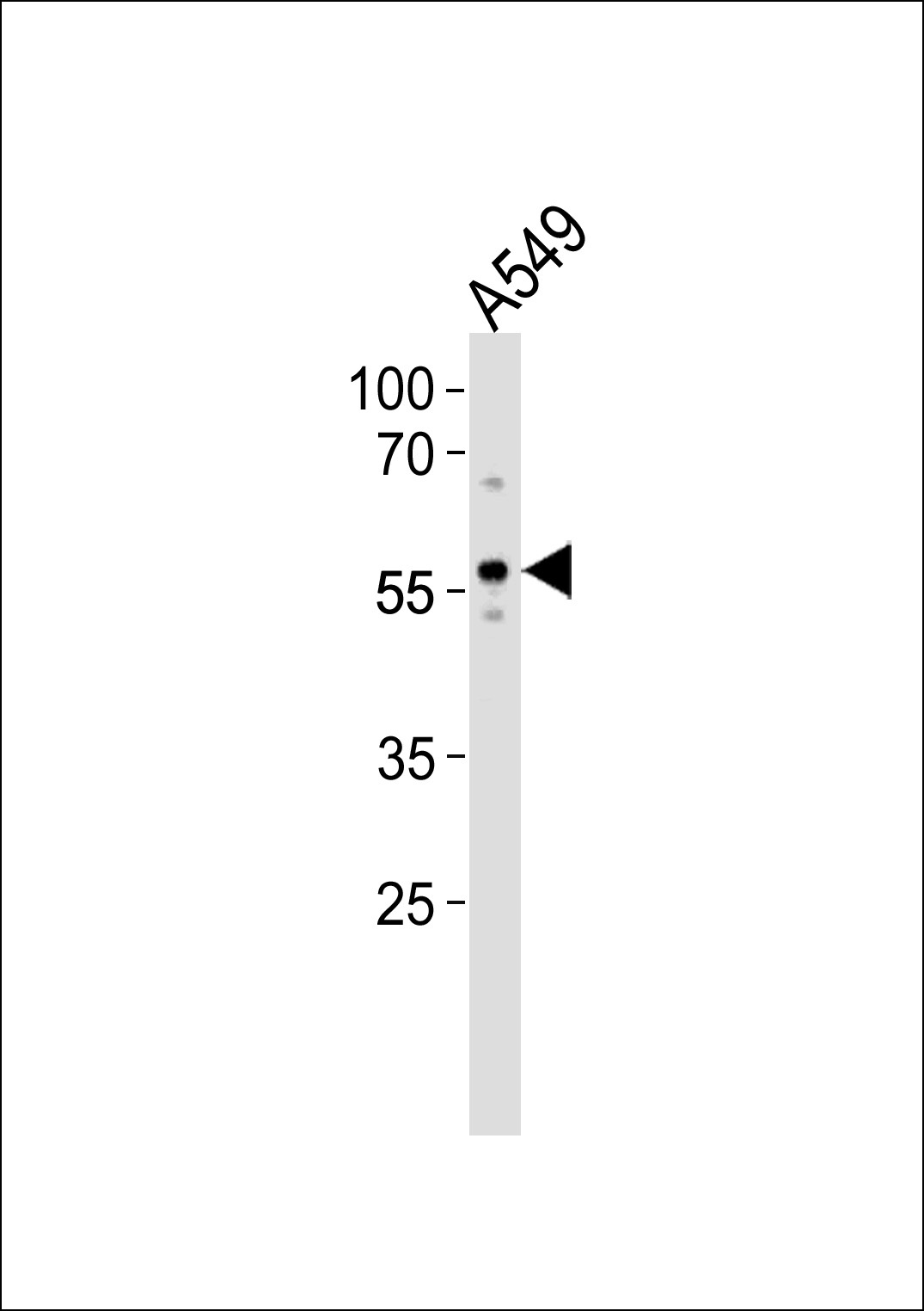ZKSCAN4 Antibody