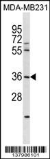 RNF217 Antibody