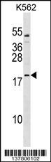 TCF15 Antibody