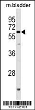 PGM2L1 Antibody