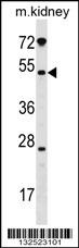 GALNT13 Antibody