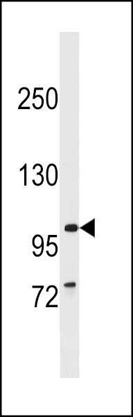 BBS9 Antibody