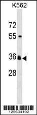 ORNT2 Antibody