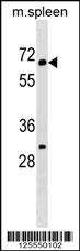 KLHL22 Antibody