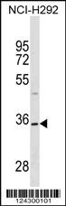 TSPAN18 Antibody