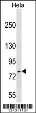 FASTKD3 Antibody