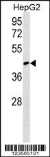 RCSD1 Antibody