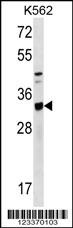 TIPRL Antibody