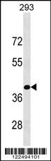 KLF15 Antibody