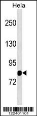 MASP1 Antibody