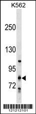 GLT25D2 Antibody