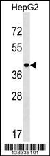 LRR1 Antibody