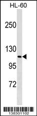 MPHOSPH9 Antibody