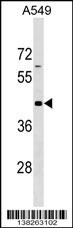 GPR62 Antibody