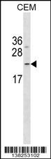 FNDC4 Antibody