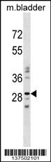 NUBPL Antibody