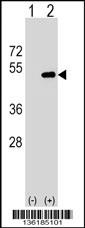 FNTA Antibody