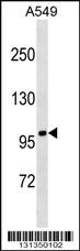 FANCB Antibody