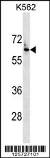 FZD7 Antibody