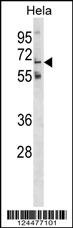 GALNT11 Antibody