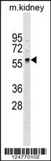 GALNT11 Antibody