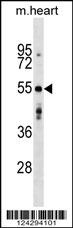 AGPAT9 Antibody