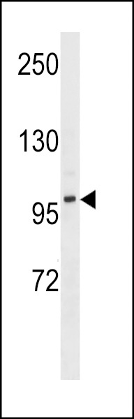 DMGDH Antibody