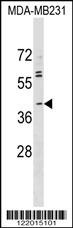 ABO Antibody
