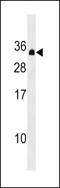 PDCD10 Antibody