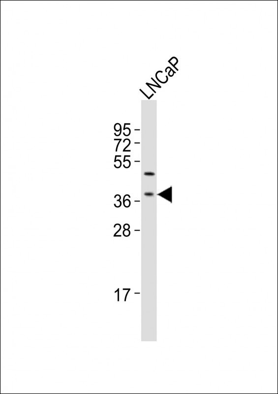 LGALS8 Antibody