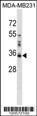 LGALS8 Antibody