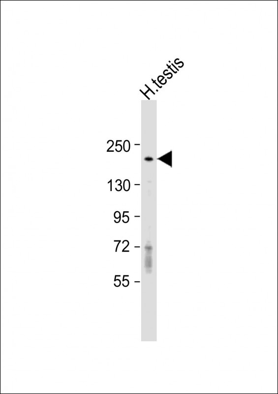 DLEC1 Antibody