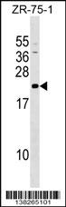 GRPEL1 Antibody