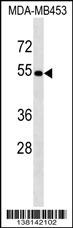 ACCS Antibody