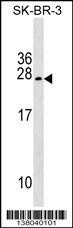 TUSC5 Antibody