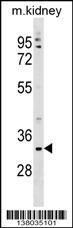 TMEM178A Antibody