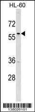 TFAP2D Antibody