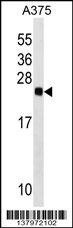 RAB2B Antibody