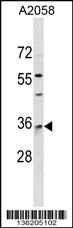RAB40A Antibody