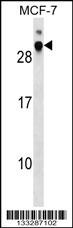 DNAJB9 Antibody