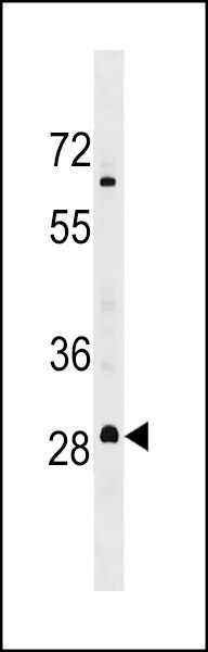 MARCH3 Antibody