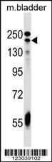 ADCY9 Antibody