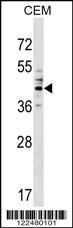 CEACAM6 Antibody