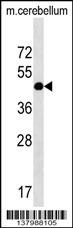 RQCD1 Antibody