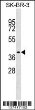 TRAM1 Antibody